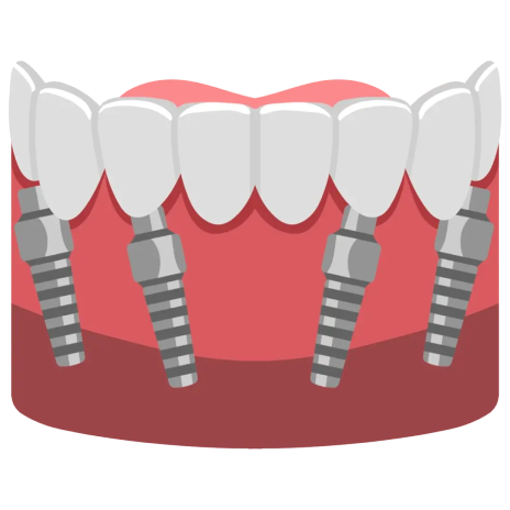 zirconium crown